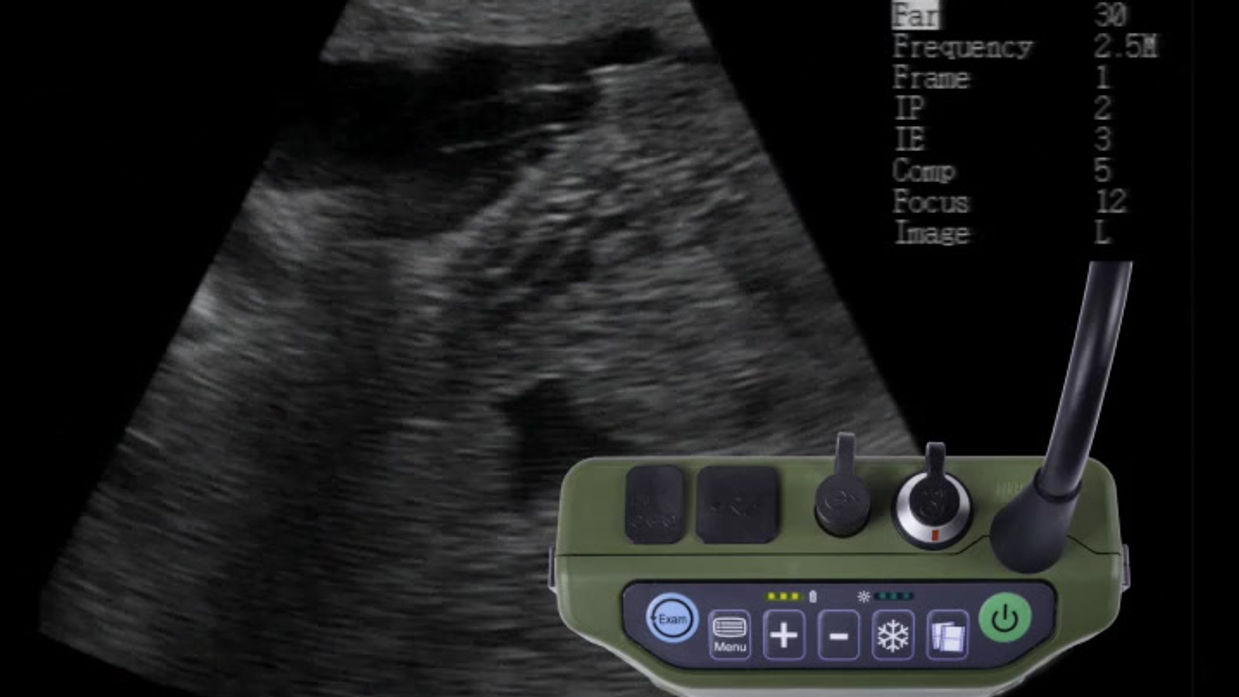 Setting your XTC for 3rd Trimester Cows 10302019